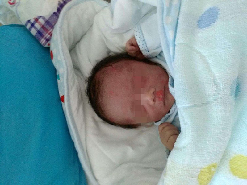 多囊卵巢通过美亚麟喜助孕公司成功得女