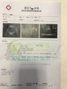 提前恭喜重庆z哥，一次成的男宝哦，还有一个半